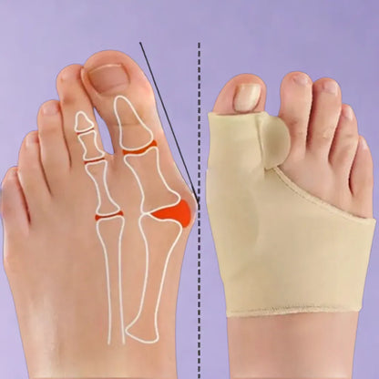 FlexiPro™ | Correcteur d'Hallux Valgus - Elixirios
